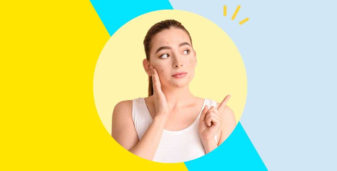 acne due to sunscreen