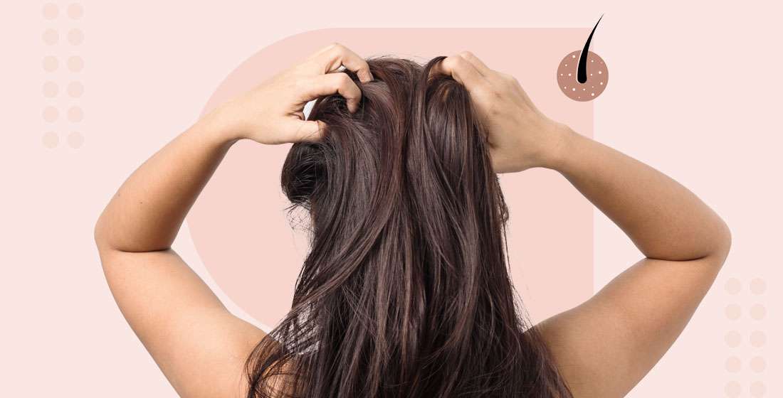 itchy scalp